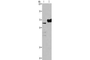 Western Blotting (WB) image for anti-Choline Dehydrogenase (CHDH) antibody (ABIN2423153)