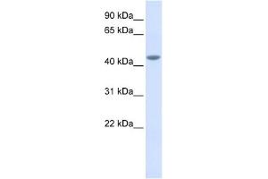 IL11R alpha antibody used at 1 ug/ml to detect target protein.