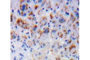 Used in DAB staining on fromalin fixed paraffin-embedded Liver tissue (CD1d antibody  (AA 32-302))