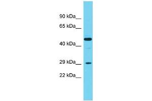 Host:  Rabbit  Target Name:  Cpa2  Sample Type:  Rat Spleen lysates  Antibody Dilution:  1. (Carboxypeptidase A2 antibody  (Middle Region))
