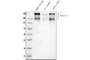 Western blot analysis of SLC12A1 using anti-SLC12A1 antibody (ABIN6719532).