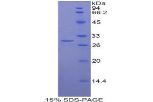 SDS-PAGE analysis of Human Myosin IG Protein. (MYO1G Protein)