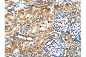 GCNT3 antibody was used for immunohistochemistry at a concentration of 4-8 ug/ml. (GCNT3 antibody)