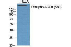 Western Blotting (WB) image for anti-Acetyl-CoA Carboxylase alpha (ACACA) (pSer80) antibody (ABIN3182481)