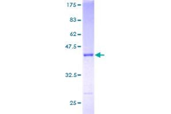 Sorting Nexin 3 Protein (SNX3) (AA 1-113) (GST tag)