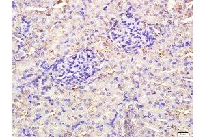 Paraformaldehyde-fixed, paraffin embedded rat kidney tissue, Antigen retrieval by boiling in sodium citrate buffer(pH6) for 15min, Block endogenous peroxidase by 3% hydrogen peroxide for 30 minutes, Blocking buffer (normal goat serum) at 37°C for 20min, Antibody incubation with Rabbit Anti-TLR3 Polyclonal Antibody, Unconjugated  at 1:400 overnight at 4°C, followed by a conjugated secondary and DAB staining (TLR3 antibody  (AA 801-905))