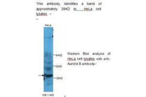 Image no. 1 for anti-Aurora Kinase B (AURKB) antibody (ABIN790822) (Aurora Kinase B antibody)
