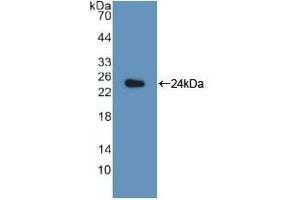 Detection of Recombinant LMP7, Rat using Polyclonal Antibody to Large Multifunctional Peptidase 7 (LMP7) (PSMB8 antibody  (AA 80-261))