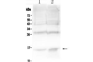 Western blot analysis of Hemoglobin using anti- Hemoglobin antibody . (Hemoglobin Alpha 1 + 2 (HBA1,HBA2) (AA 2-142) antibody)