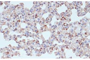 Immunohistochemistry of paraffin-embedded Rat lung using PDGFR beta Polyclonal Antibody at dilution of 1:100 (40x lens).