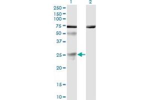 Western Blot analysis of TWSG1 expression in transfected 293T cell line by TWSG1 monoclonal antibody (M01), clone 6E6. (TWSG1 antibody  (AA 124-223))