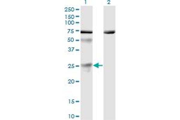 TWSG1 anticorps  (AA 124-223)