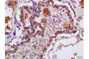 Formalin-fixed and paraffin embedded mouse placenta labeled with Anti-Hemoglobin alpha Polyclonal Antibody, Unconjugated (ABIN1387969) at 1:200 followed by conjugation to the secondary antibody and DAB staining (Hemoglobin Alpha 1 + 2 (HBA1,HBA2) (AA 10-60) antibody)