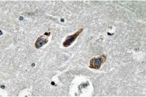 Immunohistochemistry (IHC) analyzes of Annexin II antibody in paraffin-embedded human brain tissue. (Annexin A2 antibody)