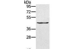 Western Blot analysis of A549 cell using KRT31 Polyclonal Antibody at dilution of 1:500