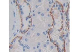 Figure. (IL18RAP antibody  (AA 310-451))