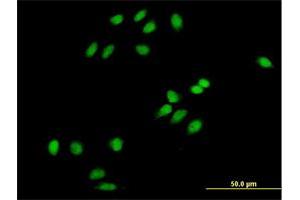 Immunofluorescence of purified MaxPab antibody to PCOLN3 on HeLa cell. (CHMP1A antibody  (AA 1-196))