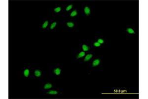 Immunofluorescence of purified MaxPab antibody to PCOLN3 on HeLa cell.