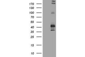 Image no. 2 for anti-Fc Fragment of IgE, Low Affinity II, Receptor For (CD23) (FCER2) (AA 48-321) antibody (ABIN1491554) (FCER2 antibody  (AA 48-321))