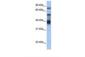 Image no. 1 for anti-Zinc Finger Protein 395 (ZNF395) (AA 218-267) antibody (ABIN6737715) (ZNF395 antibody  (AA 218-267))