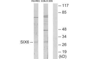 Western blot analysis of extracts from HUVEC cells and COLO205 cells, using SIX6 antibody. (SIX Homeobox 6 antibody  (Internal Region))