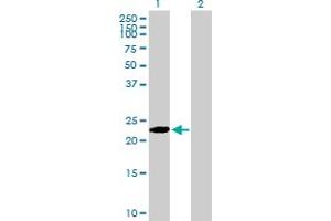 Western Blot analysis of BIN3 expression in transfected 293T cell line by BIN3 MaxPab polyclonal antibody.