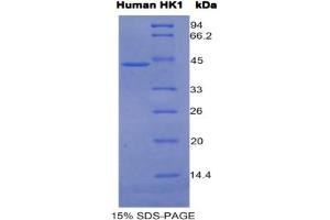 SDS-PAGE analysis of Human Hexokinase 1 Protein. (Hexokinase 1 Protein (HK1))