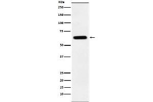 Western blot analysis of CRMP5 expression in SH-SY5Y cell lysate.