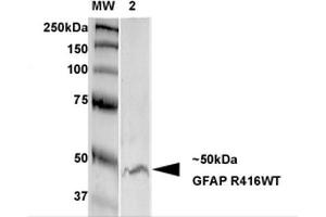 Western Blot analysis of Rat Brain Membrane showing detection of GFAP protein using Mouse Anti-GFAP Monoclonal Antibody, Clone S206B-9 . (GFAP antibody  (AA 411-422) (Biotin))