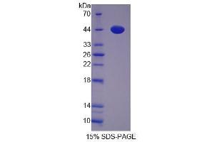 Image no. 1 for Uroporphyrinogen Decarboxylase (UROD) (AA 1-364) protein (His tag) (ABIN6237169)