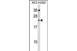 MED19 Antibody (C-term) (ABIN1536757 and ABIN2850102) western blot analysis in NCI- cell line lysates (35 μg/lane). (MED19 antibody  (C-Term))