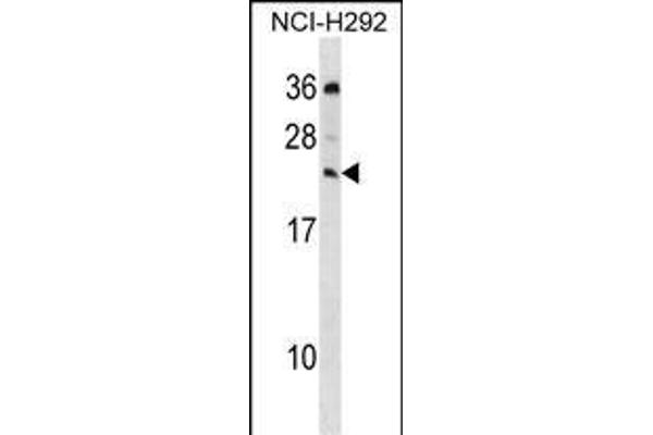 MED19 anticorps  (C-Term)