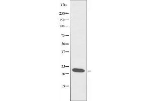 Western blot analysis of extracts from RAW264. (CIDEB antibody  (Internal Region))