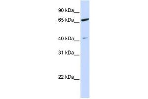ZNF334 antibody used at 0. (ZNF334 antibody  (N-Term))