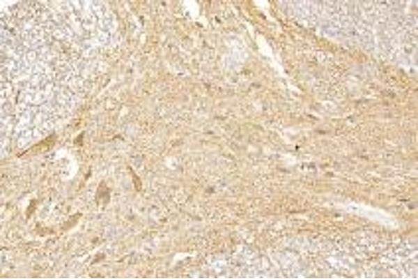 GDF6 antibody