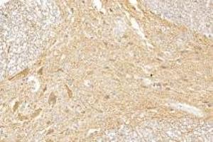 Immunohistochemistry analysis of paraffin-embedded rat spinal cord using,GDF6 (ABIN7074132) at dilution of 1: 1000 (GDF6 antibody)