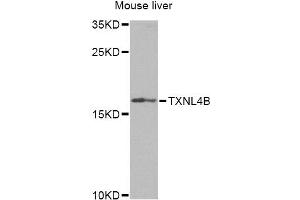 Western blot analysis of extracts of mouse liver, using TXNL4B Antibody (ABIN2560623) at 1:1000 dilution.