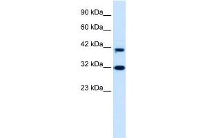 WB Suggested Anti-DPF1 Antibody Titration:  0. (DPF1 antibody  (Middle Region))
