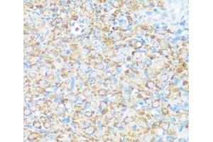 Immunohistochemistry of paraffin-embedded Rat ovary using NMT1 Polyclonal Antibody at dilution of 1:100 (40x lens). (NMT1 antibody)