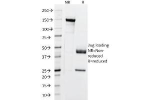 SDS-PAGE Analysis Purified Cytokeratin, 5/6/18 Mouse Monoclonal Antibody (SPM267). (Keratin 5,6,18 antibody)