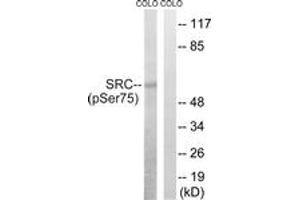 Western blot analysis of extracts from COLO205 cells treated with EGF 200ng/ml 30', using Src (Phospho-Ser75) Antibody. (Src antibody  (pSer75))
