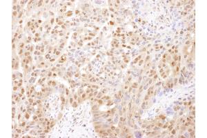 Immunohistochemistry (IHC) image for anti-Proteasome Subunit alpha 2 (PSMA2) (AA 184-234) antibody (ABIN7454564) (PSMA2 antibody  (AA 184-234))