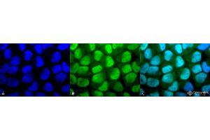 Immunocytochemistry/Immunofluorescence analysis using Rabbit Anti-Methylated Lysine Polyclonal Antibody . (Lysine (lys) (methylated) antibody (HRP))