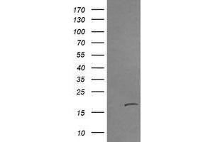 Image no. 2 for anti-Cancer/testis Antigen 1B (CTAG1B) antibody (ABIN1499893) (CTAG1B antibody)
