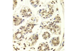 Immunohistochemistry of paraffin-embedded human breast using PRPF3 Antibody (ABIN5973192) at dilution of 1/100 (40x lens). (PRPF3 antibody)
