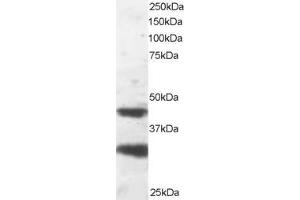 Western Blotting (WB) image for anti-Platelet-Activating Factor Acetylhydrolase 1b, Regulatory Subunit 1 (45kDa) (PAFAH1B1) (C-Term) antibody (ABIN184751)