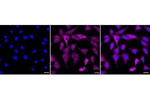 Immunocytochemical staining of C2C12 cells with Phospho-MEK1 (S298) antibody (ABIN7799462), 1:1,000). (Recombinant MEK1 antibody  (pSer298))
