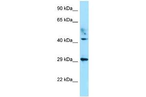 WB Suggested Anti-ATCAY Antibody Titration: 1. (ATCAY antibody  (C-Term))