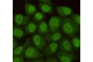 Immunocytochemistry staining of HeLa cells fixed with 4 % Paraformaldehyde and using anti-hHR23b antibody (dilution 1:100). (RAD23B antibody)