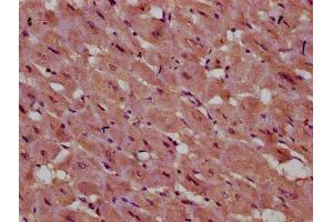 IHC image of ABIN7142862 diluted at 1:400 and staining in paraffin-embedded human heart tissue performed on a Leica BondTM system. (INPP5E antibody  (AA 1-133))